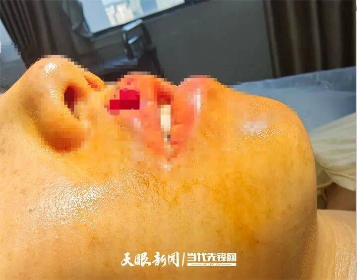 女子上门代喂，被100多斤阿拉斯加犬咬伤遭毁容，狗主人称不担全责